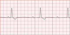 <p>identify the rhythm</p>