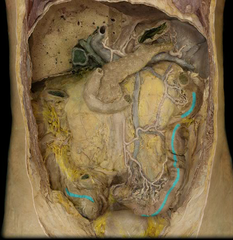 <p>identify the structure</p>