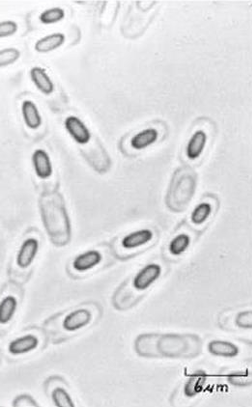 <p>identify;</p><ul><li><p>spore location</p></li><li><p>bacteria</p></li></ul><p></p>