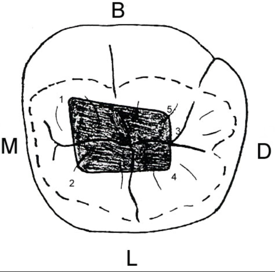 <p>What should your access look like for a mandibular molar?</p>