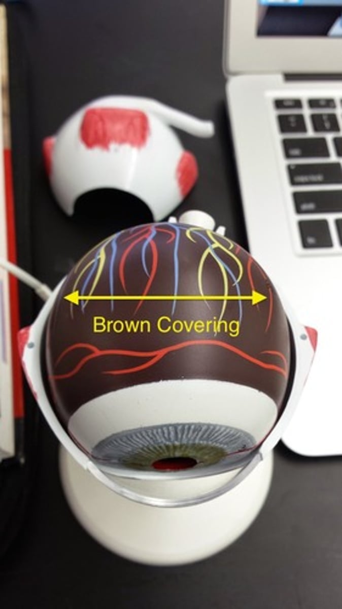 <p>What part of the eye is this? (Brown Covering)</p>