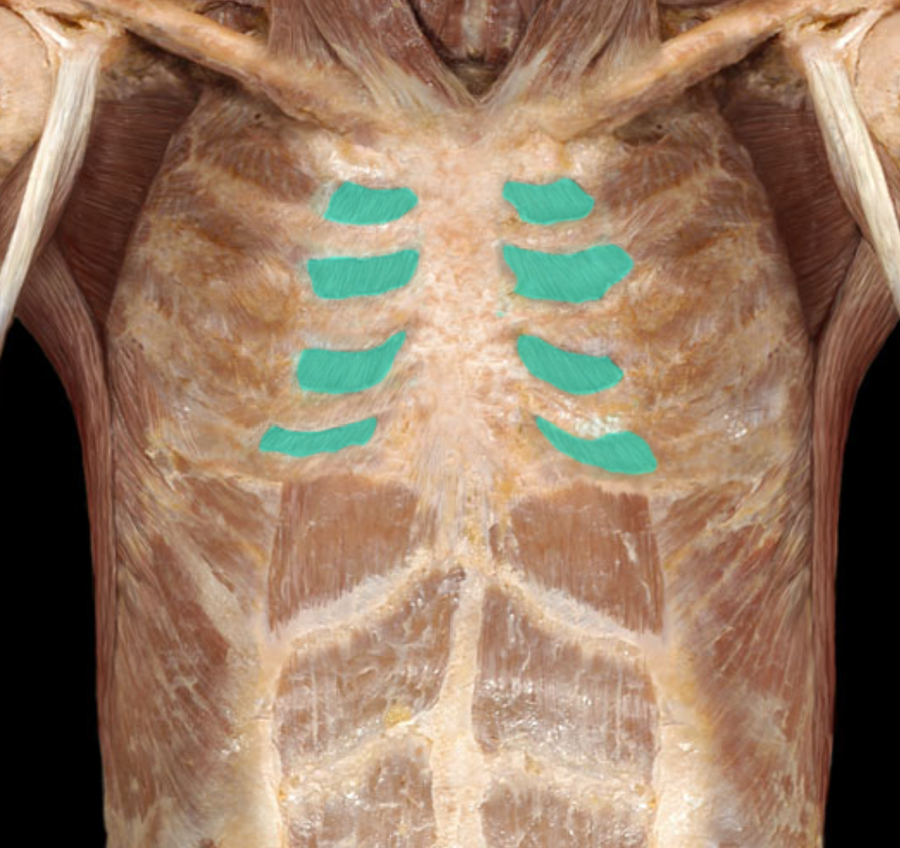 <p>Action:</p><ul><li><p>Muscle of respiration</p></li><li><p>Depression of ribs during forced exhalation to decrease transverse dimensions (anterior-posterior, medial-lateral) of thoracic cavity</p></li></ul><p>Origin:</p><ul><li><p>Superior border of rib (ribs 1-11)</p></li></ul><p>Insertion:</p><ul><li><p>Inferior border of rib above (ribs 2-12)</p></li></ul><p>Innervation:</p><ul><li><p>Intercostal nerves (ventral rami of T1-11 spinal nerves)</p></li></ul><p>Comment:</p><ul><li><p>Internal intercostal muscle continuous with internal intercostal membrane lateral to vertebral column</p></li><li><p>Muscle fibers run inferoposteriorly</p></li><li><p>In contemporary medical anatomy books, the origins of external and internal intercostal muscles are referred to as "superior attachments" and described for both muscles as the inferior border of the rib. Similarly, the insertions of these muscles are referred to as "inferior attachments" and described as the superior border of the rib below.</p></li></ul><p></p>
