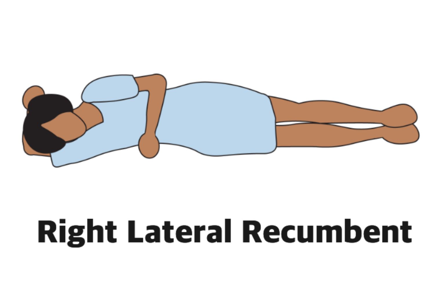 <p><span>C. Lateral recumbent with the neck and knees drawn up to the chest.</span></p>
