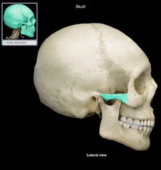 <p>Name this bone.</p>