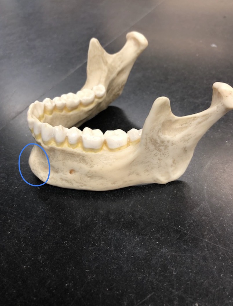 <p>what is this STRUCTURE?</p>