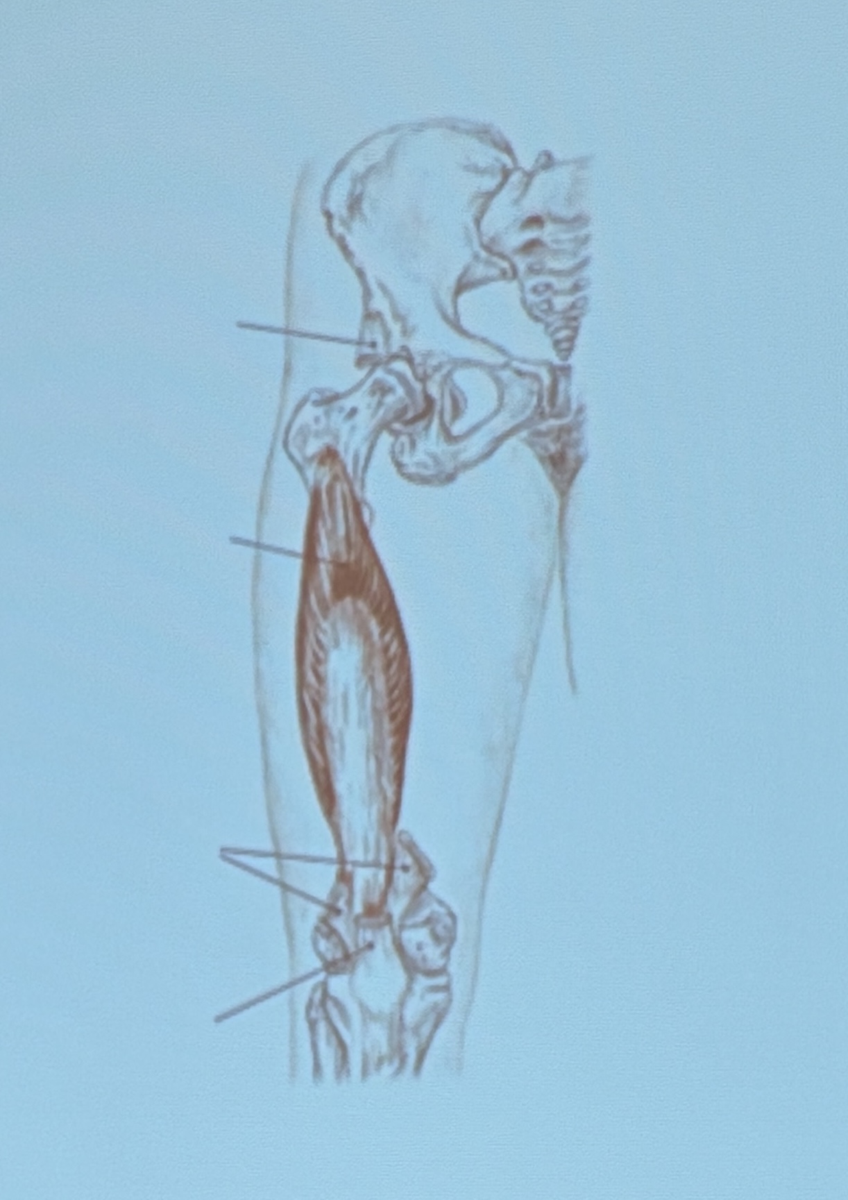 <p>Muscle name?</p>