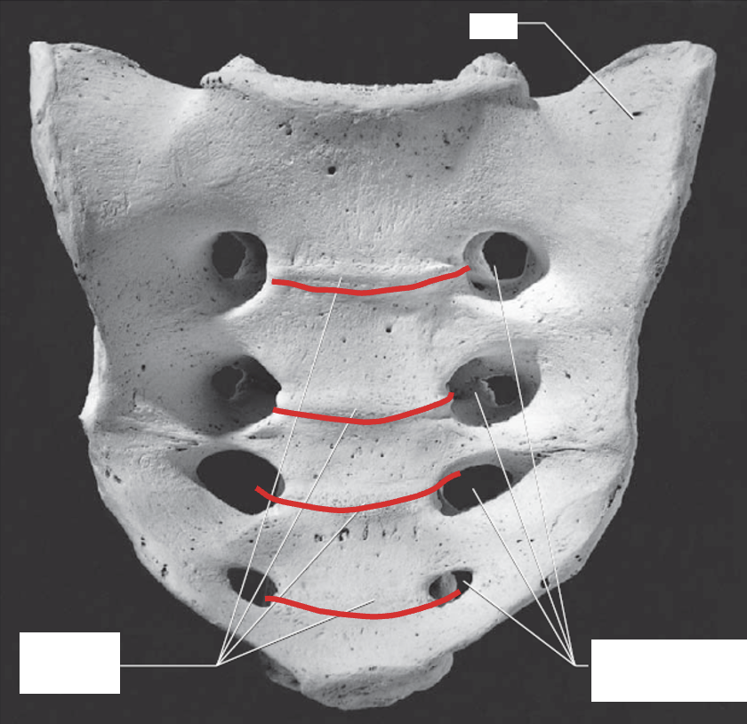 <p>Sacrum: What is the Red?</p>