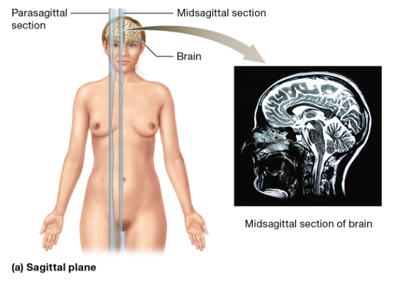 <p>Divides the body/body part into right and left sections</p><ul><li><p>Midsagittal plane (median plane): Divides the body/body part into equal right and left halves. </p></li><li><p>Parasagittal plane: Divides the body/body part into unequal right and left sections.</p></li></ul><p></p>