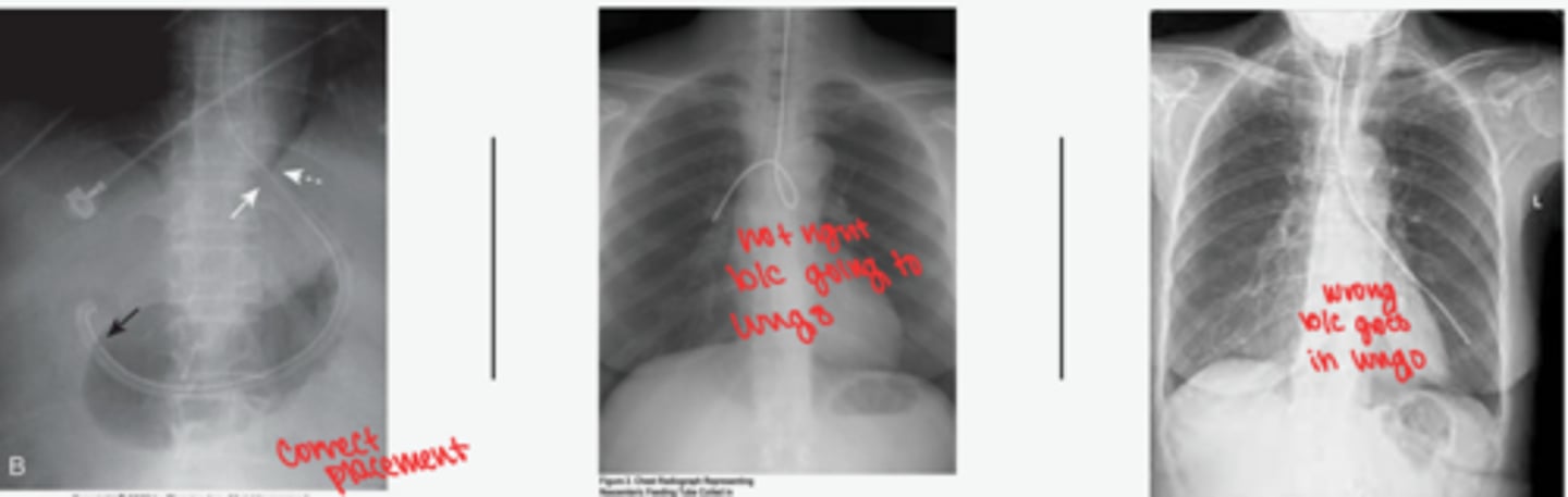 <p>find line in the neck and follow it to the stomach and the loop it makes in stomach</p>