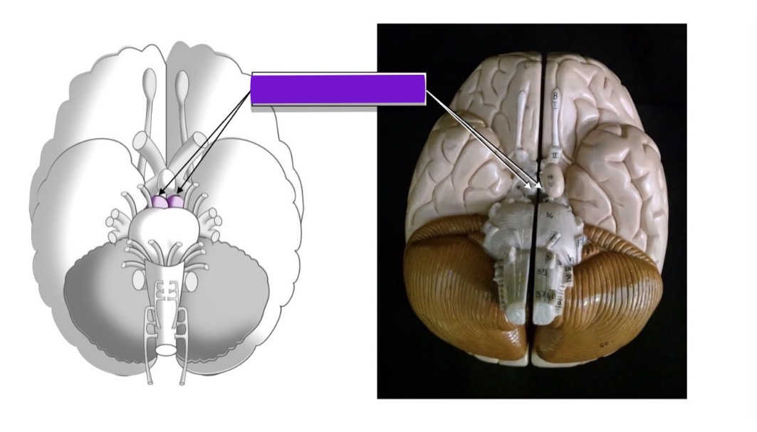 <p>what additional structure is highlighted in these images</p>