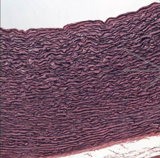 <p>What tissue?</p>