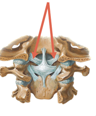 <p>What is the soft tissue structure indicated by the arrows?</p>