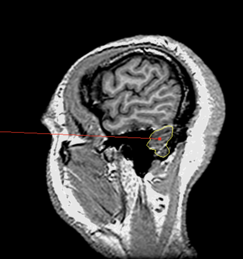 <p>What is the area highlighted called?</p>