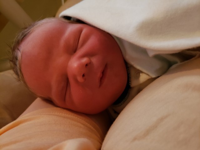 <p>ruddy color in newborn = ?</p>