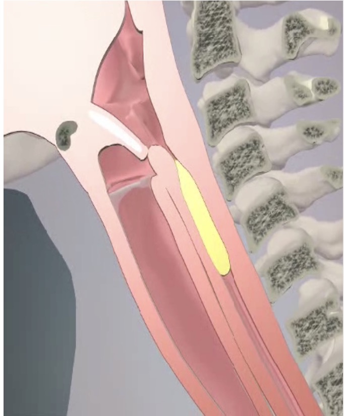 <p>Esophageal Phase</p>