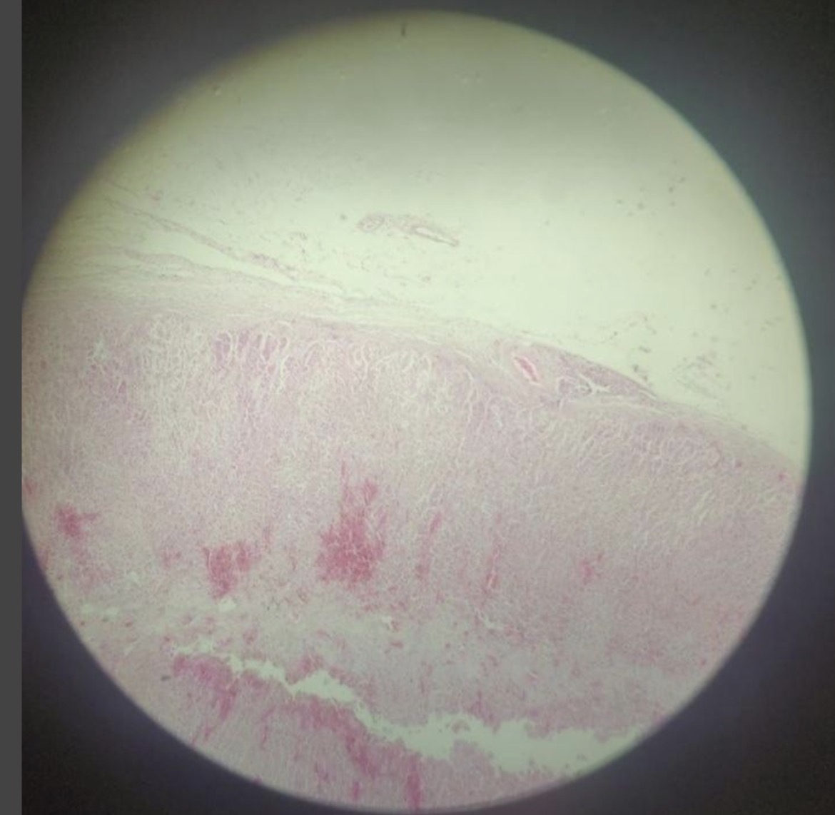 <p>Zona glomerulare (Surrene)</p>
