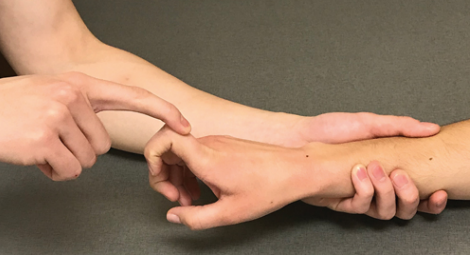 <p>forearm is pronated, supported. wrist in neutral position, fingers relaxed flexed. put one hand on the wrist/metacarpals, other hand (FINGER) on the head of the proximal carpal to push down</p><p>“lift this knuckle (touch knuckle) up as far as it will go. keep the rest of your fingers bent. do not let me push your knuckle down”</p>