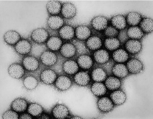 <p>What is this Waterborne Virus?</p><p>-<strong>Rotavirus</strong></p>