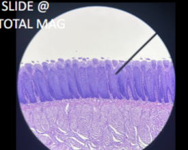 <p>What is the pointer pointing at on this papillae? </p>