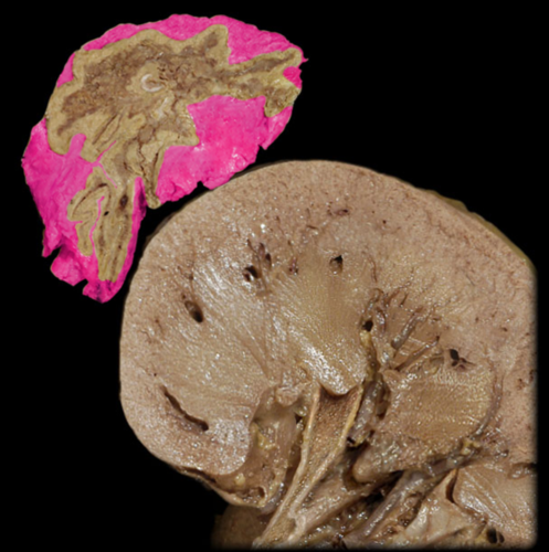 <p>Suprarenal Capsule</p>