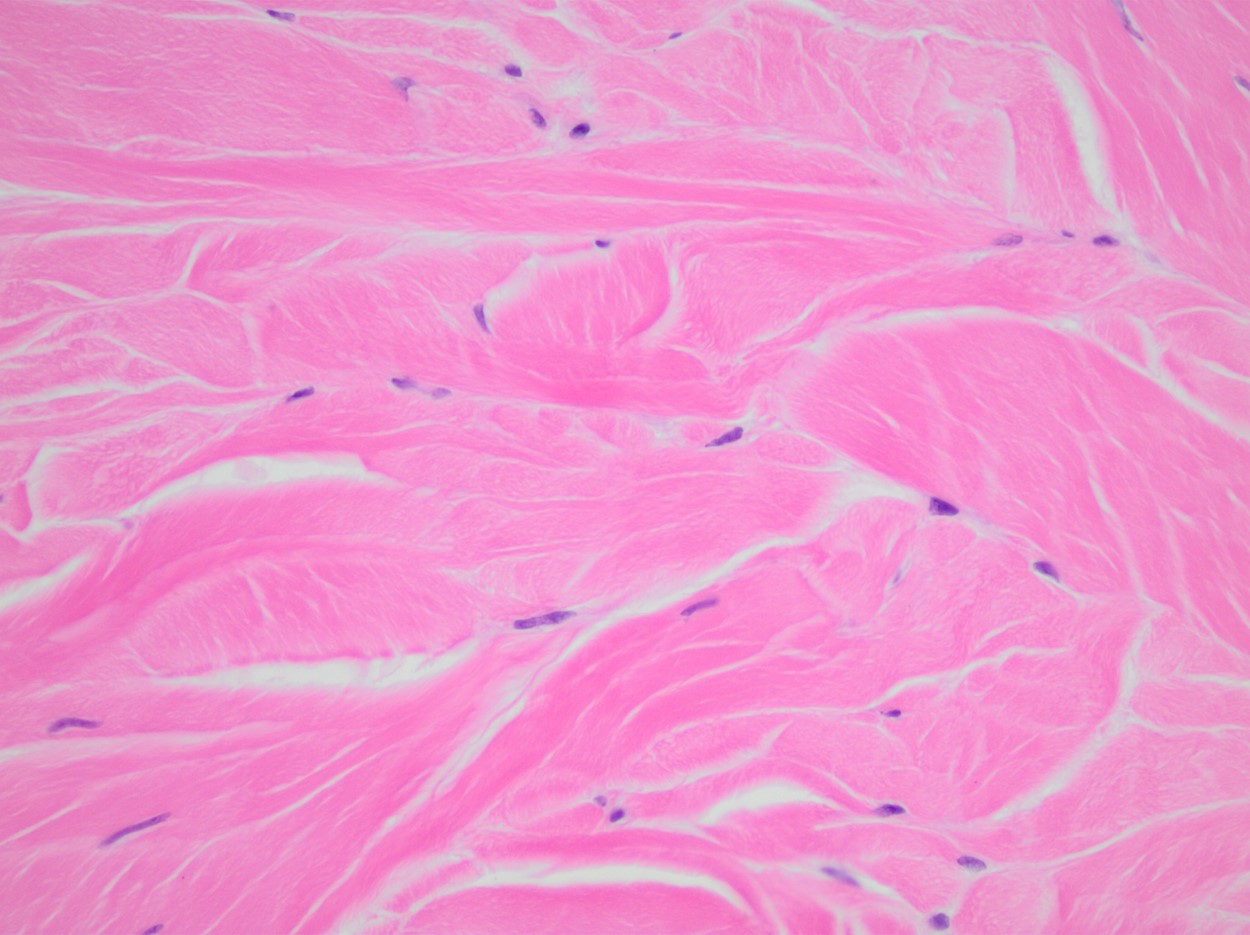 <p>Dense Regular Tissue</p>