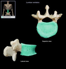 <p>Large circular portion of the vertebrae</p>