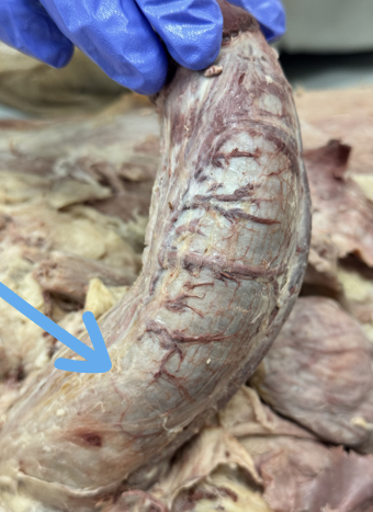 <p><span>maintains the structure of the penis</span></p>