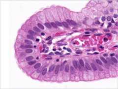 <p>Identify</p>