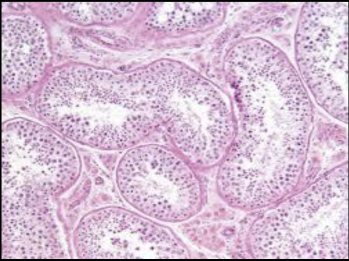 <p>Where would you find this slide?</p>