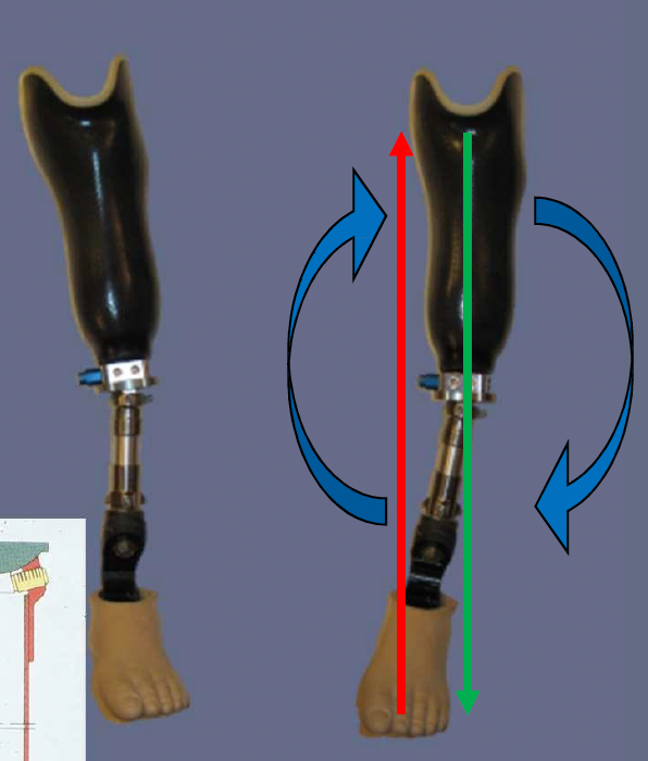 <p>medial proximal, lateral distal </p>