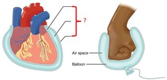 <p>secretes fluid that separates the parietal layer from the visceral layer</p>