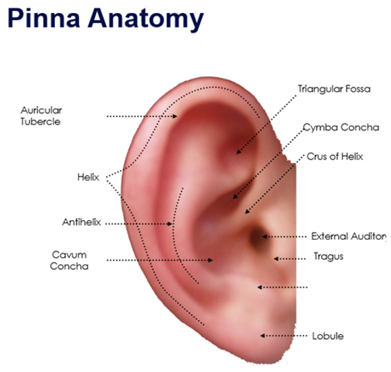 <p>label missing part</p>