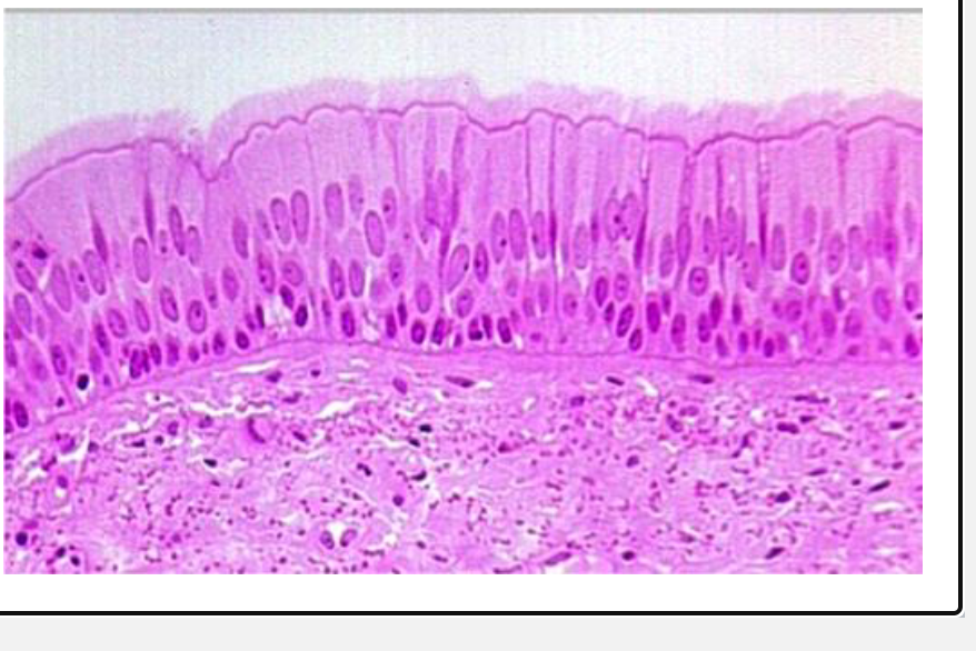 <p>Examples:</p><p>• Linings of trachea, bronchi, non-</p><p>respiratory bronchioles</p>