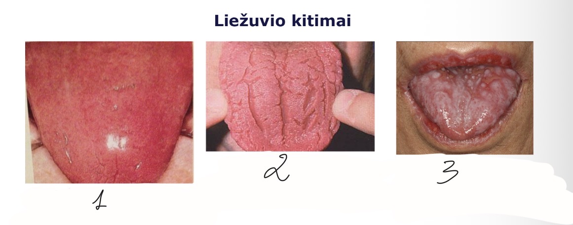 <p>3</p>