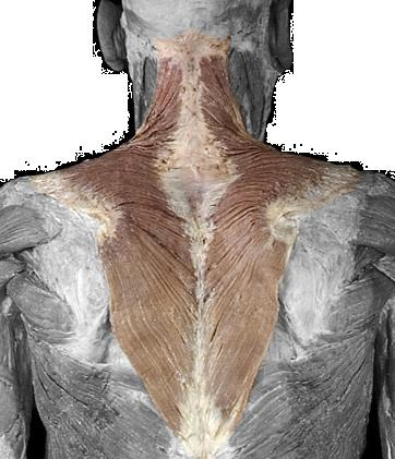 <p>What is this superficial muscle (in color)?</p>