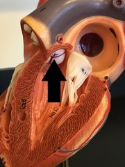 <p>Identify the structure.</p>