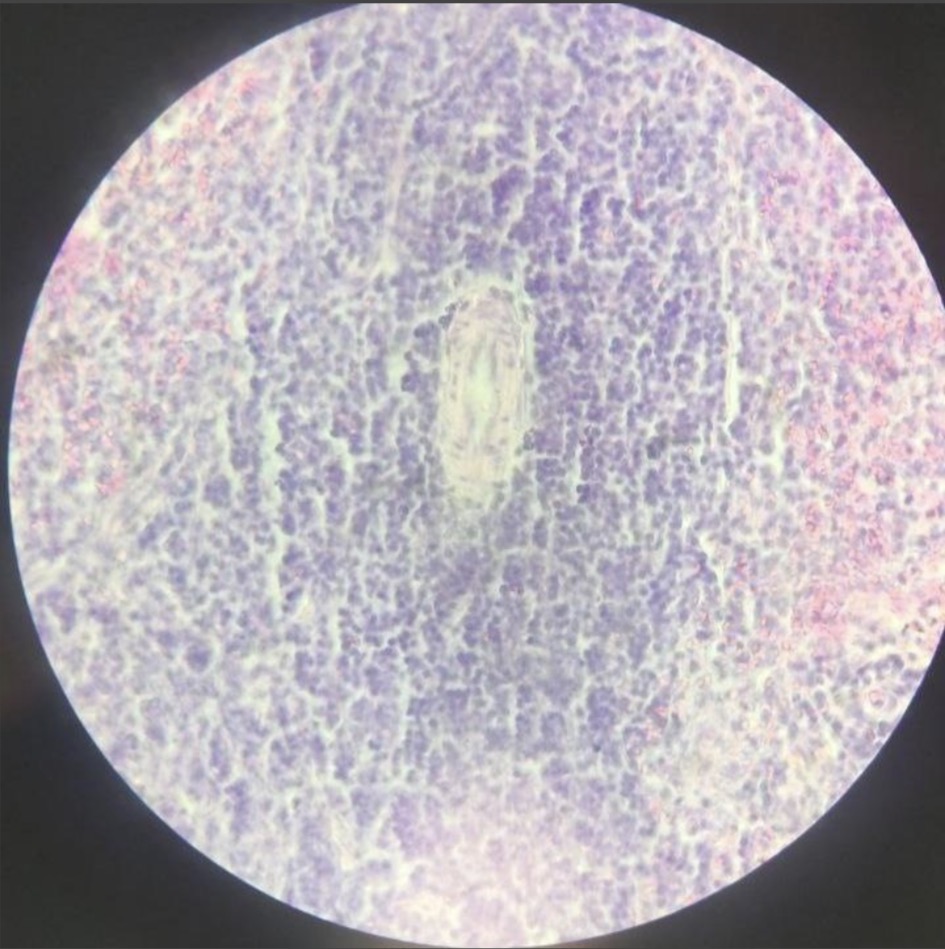 term image