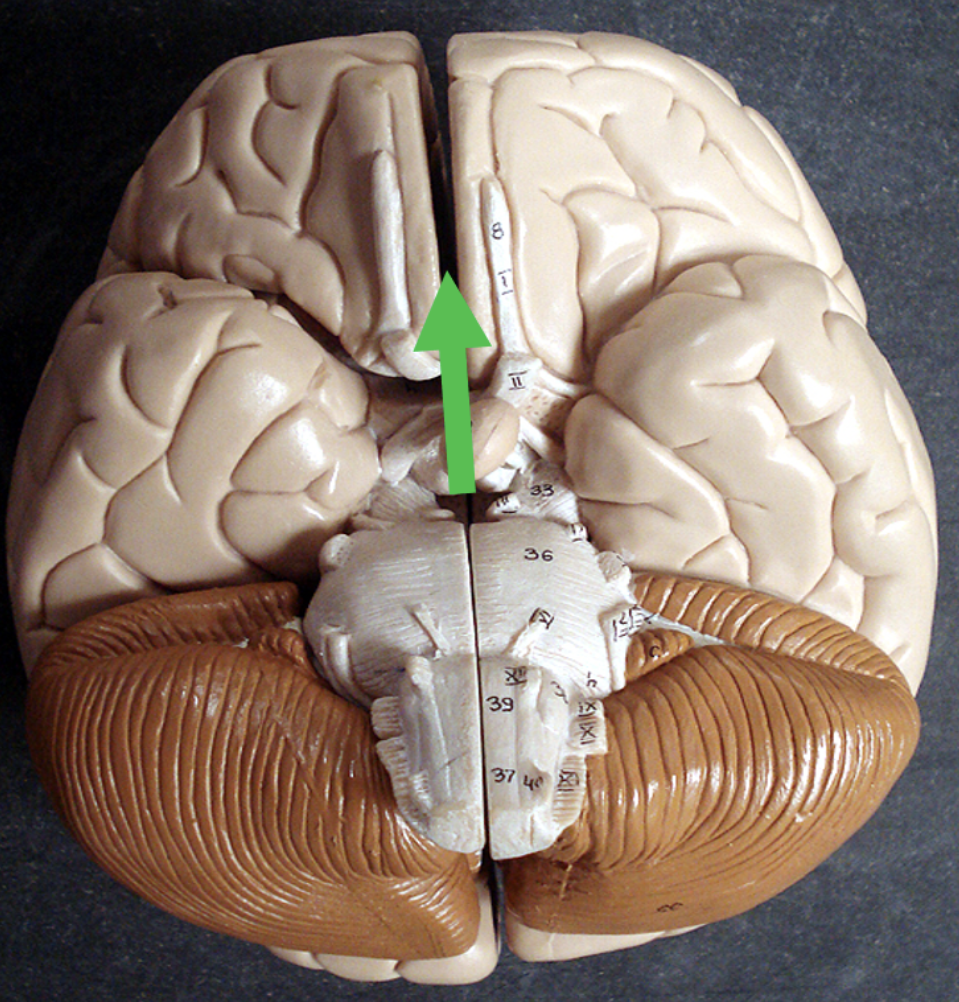 <p>Identify the space in the brain indicated by the pointer.</p>