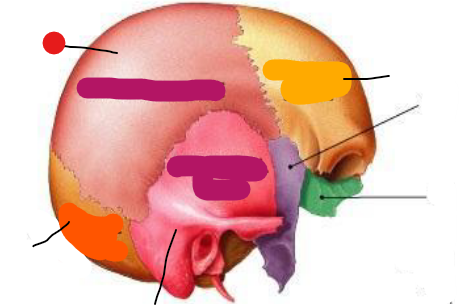 <p>Identify the structure pinned</p>
