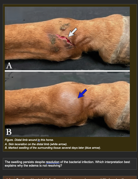 <p>A horse develops a contaminated wound on the distal forelimb. After appropriate treatment, the infection resolves and bacterial cultures are negative. However, swelling of the distal limb persists several days after resolution of infection.</p><p>Additional clinical findings:</p><p>- Arterial blood flow to the limb: normal on Doppler</p><p>- Venous pressure: within normal range</p><p>- Plasma albumin concentration: normal</p><p>- Regional lymph nodes: enlarged on palpation</p><p></p><p><strong>The swelling persists despite resolution of the bacterial infection. Which interpretation best explains why the edema is not resolving?</strong></p><p><span>a. Continued bacterial infection maintains vascular permeability keeping the inflammatory exudate active</span></p><p><span>b. Decreased plasma albumin concentration reduces plasma oncotic pressure, drawing fluid into the interstitium</span></p><p><span>c. Inflammatory fluid has accumulated normally but reduced lymphatic clearance capacity in the distal limb allows interstitial fluid to persist beyond the resolution of the acute permeability event</span></p><p><span>d. Increased venous pressure prevents reabsorption of interstitial fluid into the venous end of the capillary</span></p>