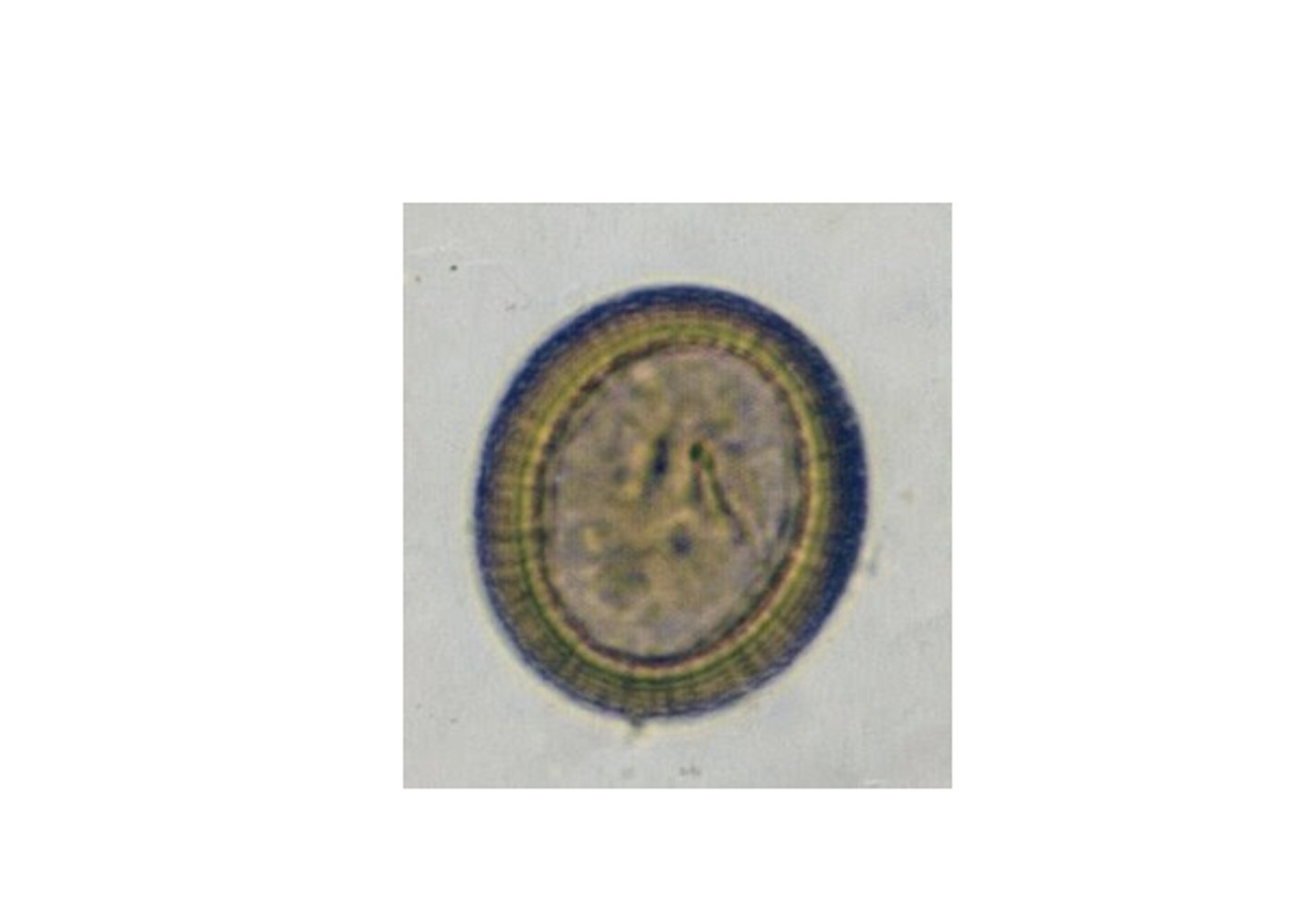 <p>ID what genus this Cestode egg belongs to:</p>