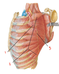 <p>What muscle is labeled 2?</p>