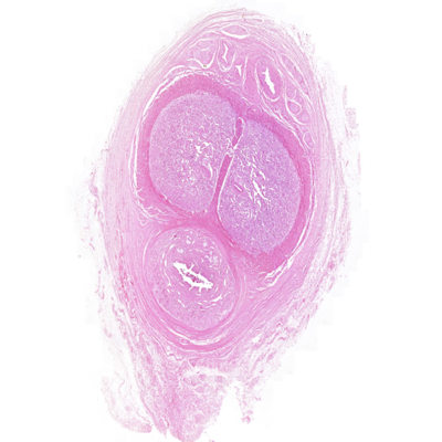 <p>El pene forma parte del aparato genitourinario masculino para la eyaculación y expulsión de orina, de acuerdo al contexto, que estructura señala? (foto de uretra)</p>