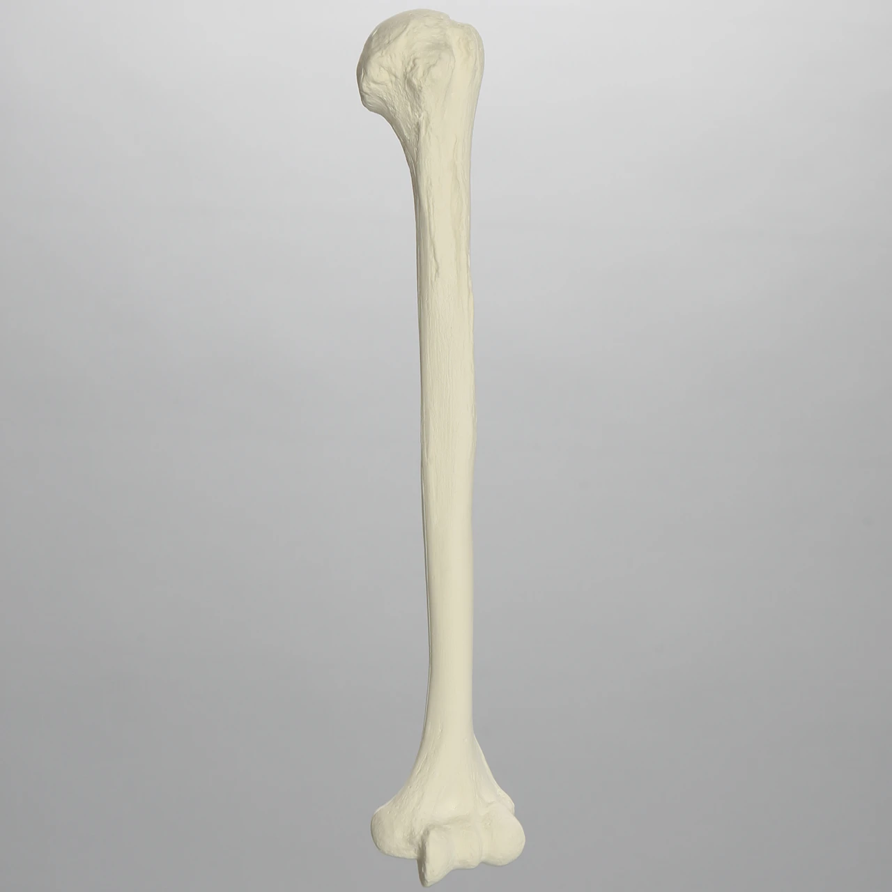 <p>Left or right bone</p>
