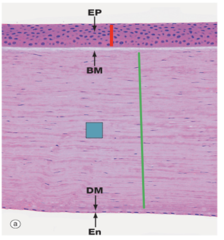 <p>Identify the layer of the cornea</p>