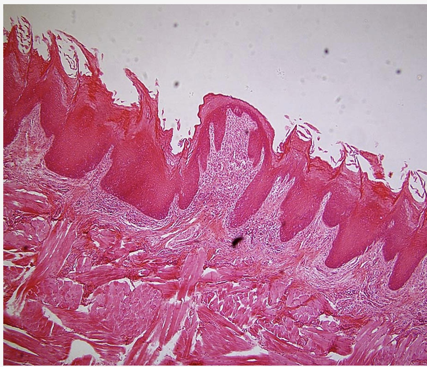 <p>Identify the mucosa </p>