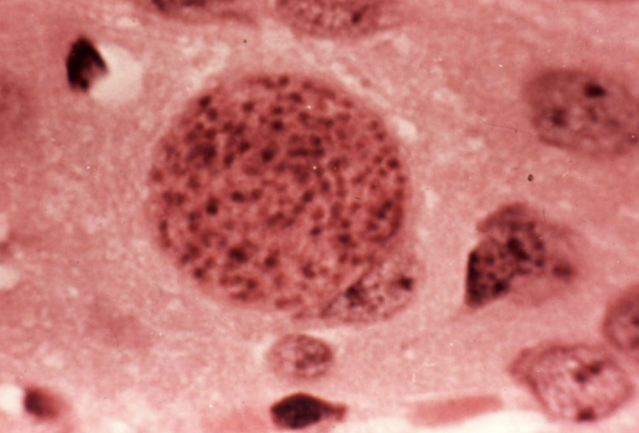 <p>What parasite is this?</p>