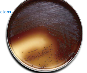 <p>anaerobic; Bacteroides; black; hydrolysis; nothing</p>