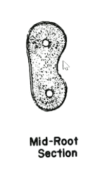 <p>- outline form is kidney shaped</p><p>- buccal and lingual outlines are convex</p><p>- deep mesial surface indentation</p><p>- distal surface flat to slightly concave</p>