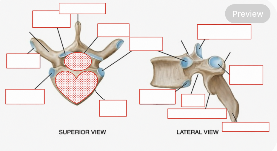 <p>Label each marking on the vertebrae, and what kind is it?</p>